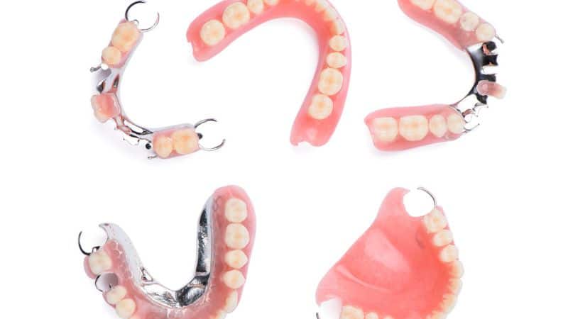 Types de prothèses dentaires : complètes et partielles - CDP